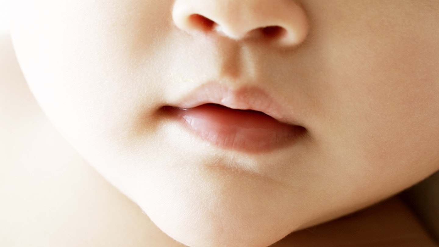 What is a lip tie?