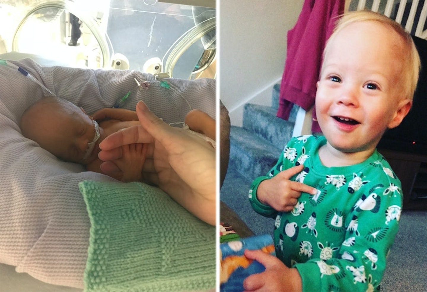 charlie-then-now-preemie
