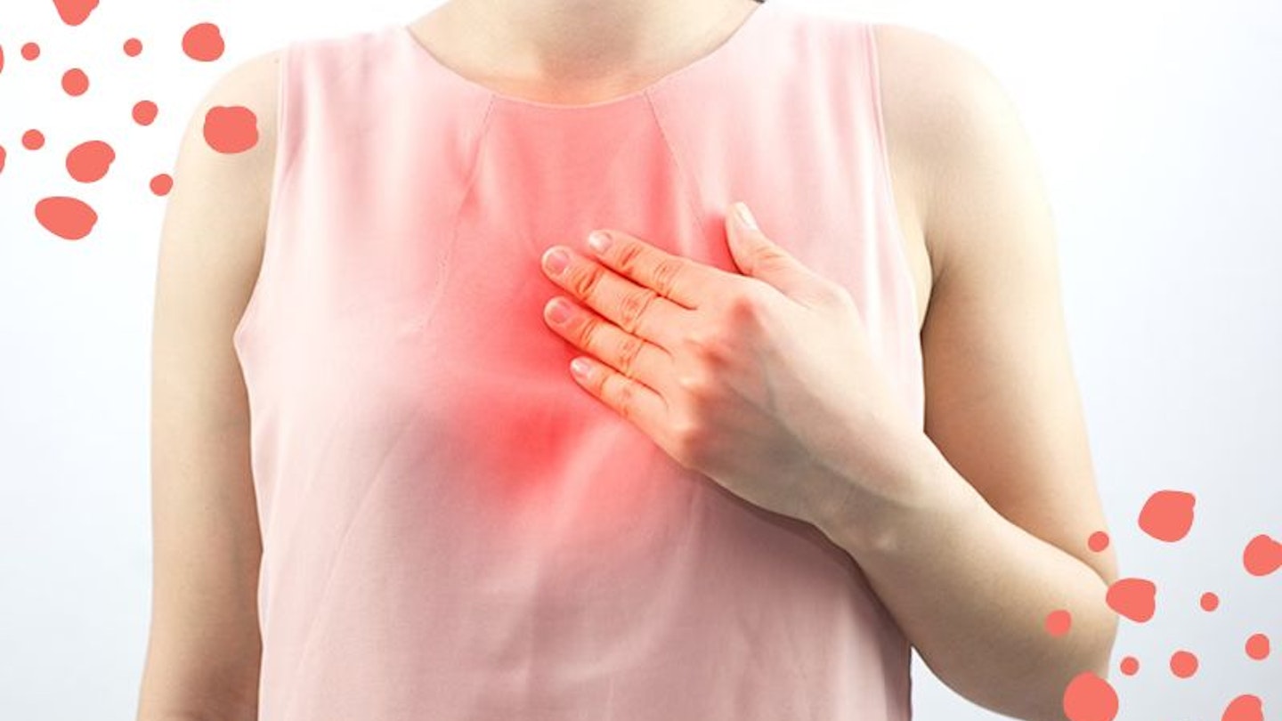 A woman holding her chest with a red warmth mark to signify heartburn in pregnancy