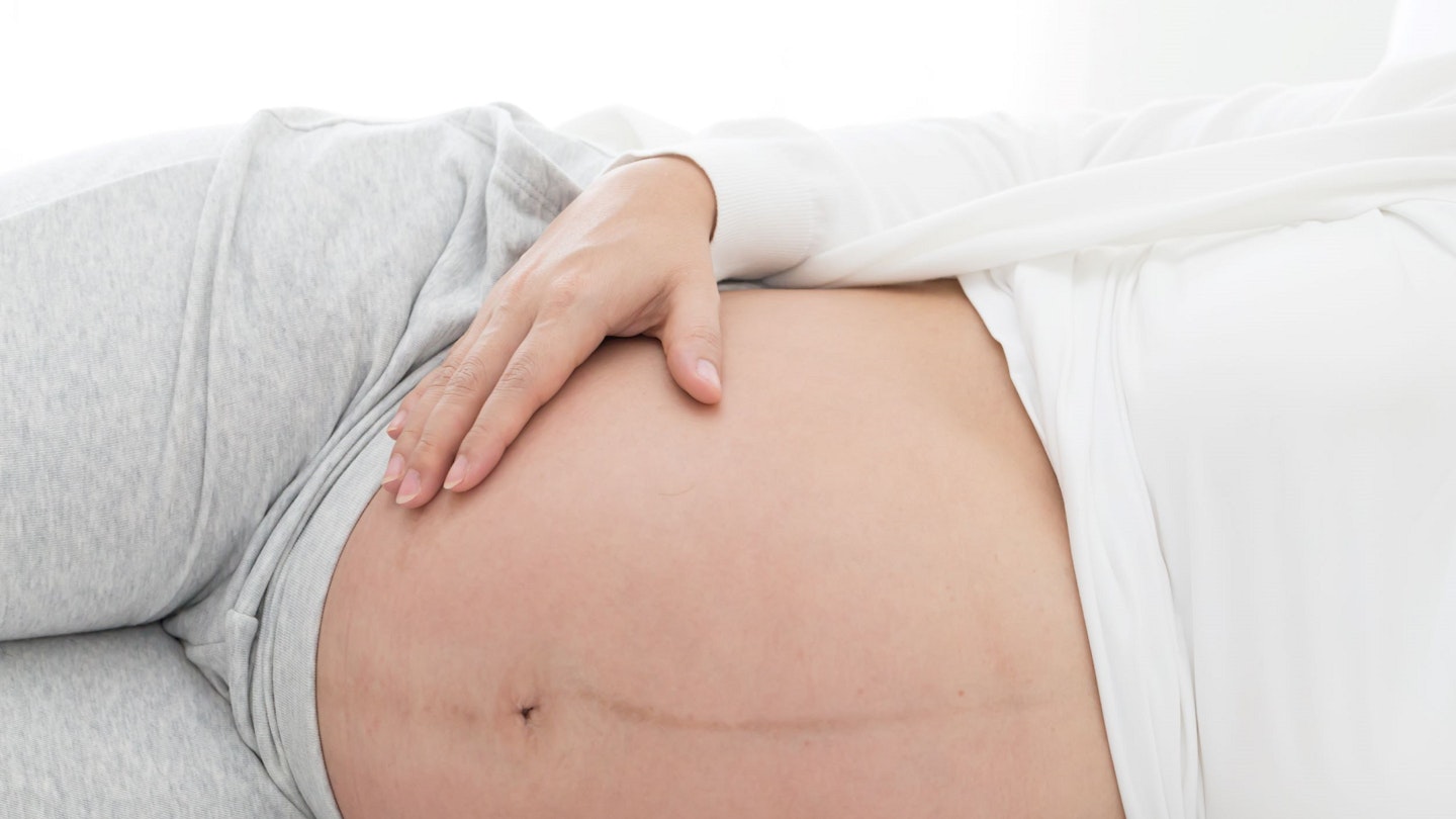 pregnant woman laying down