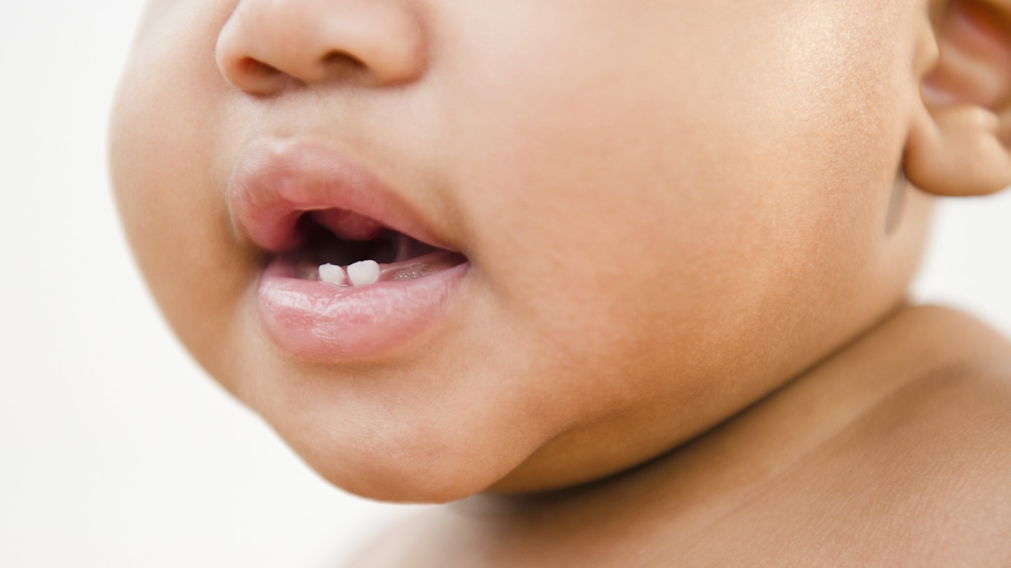 When do babies start teething? Signs and symptoms to look out for