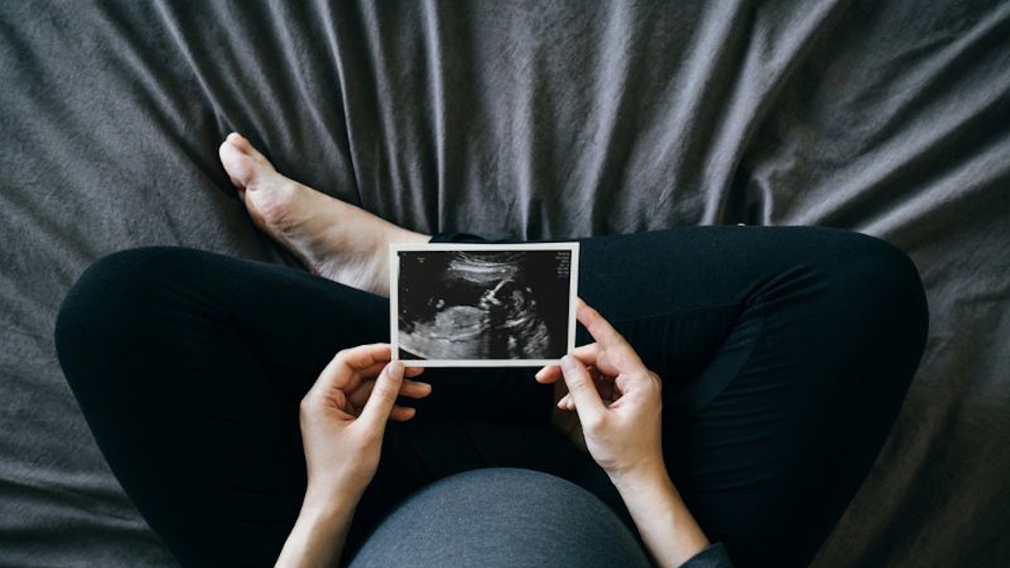 Pregnant women holding a pregnancy scan photo